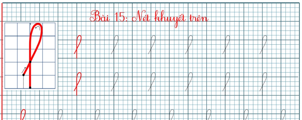 nét khuyết trên